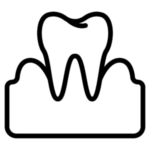 chirurgia-parodontale